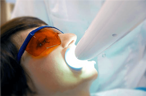 Understanding the Causes of Teeth Sensitivity Salford