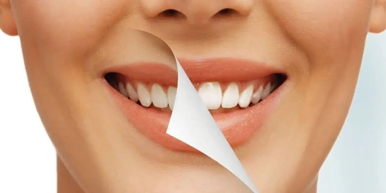 What Is Cosmetic Dentistry and How Can It Transform Your Smile Salford