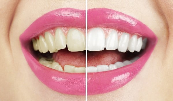 What Early Signs of Oral Cancer Should You Never Ignore Salford?