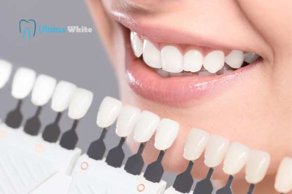 How to Maximise the Results of Your Laser Teeth Whitening Treatment Salford