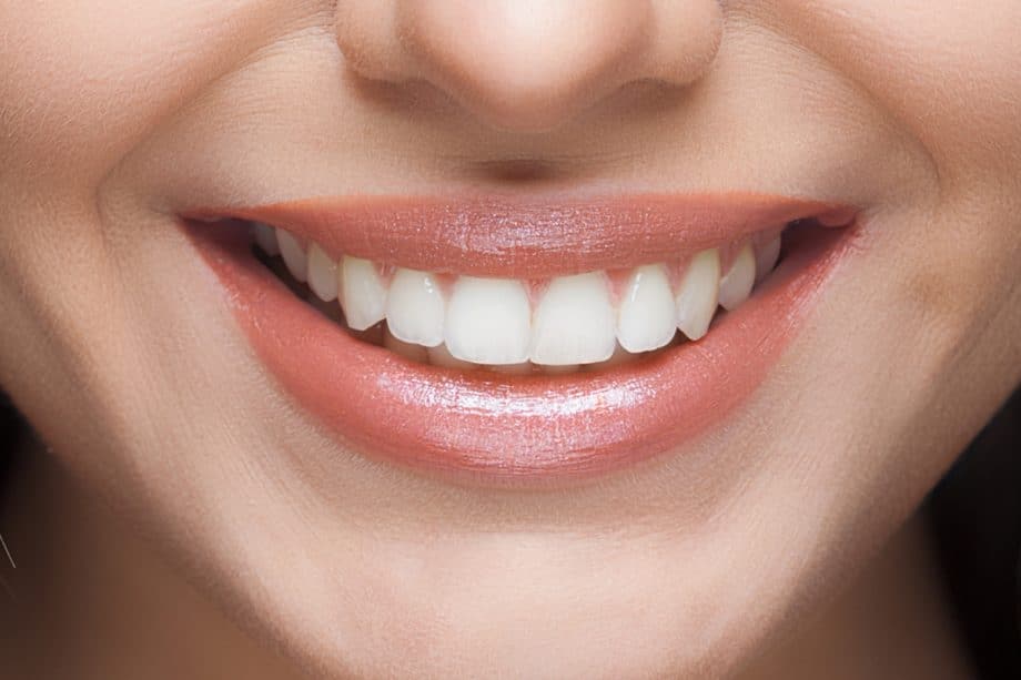 Beyond Whitening: How Your Daily Diet Affects Long-Term Smile Brightness Salford
