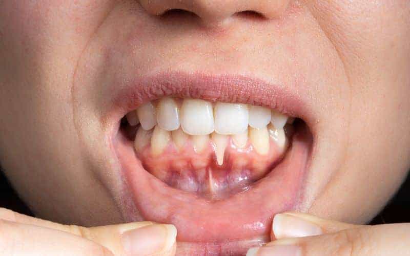 Final Thoughts: Building Lifelong Enamel Protection Habits Salford