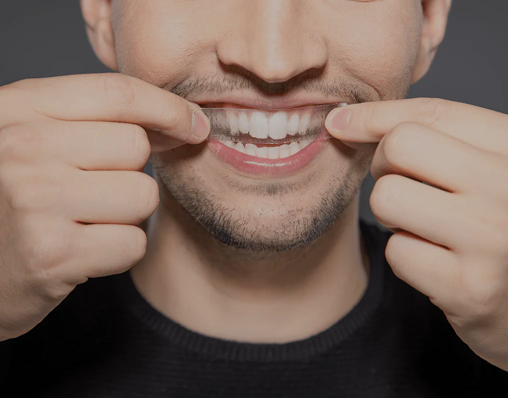 Can You Whiten Natural Teeth Without Harsh Chemicals Salford?