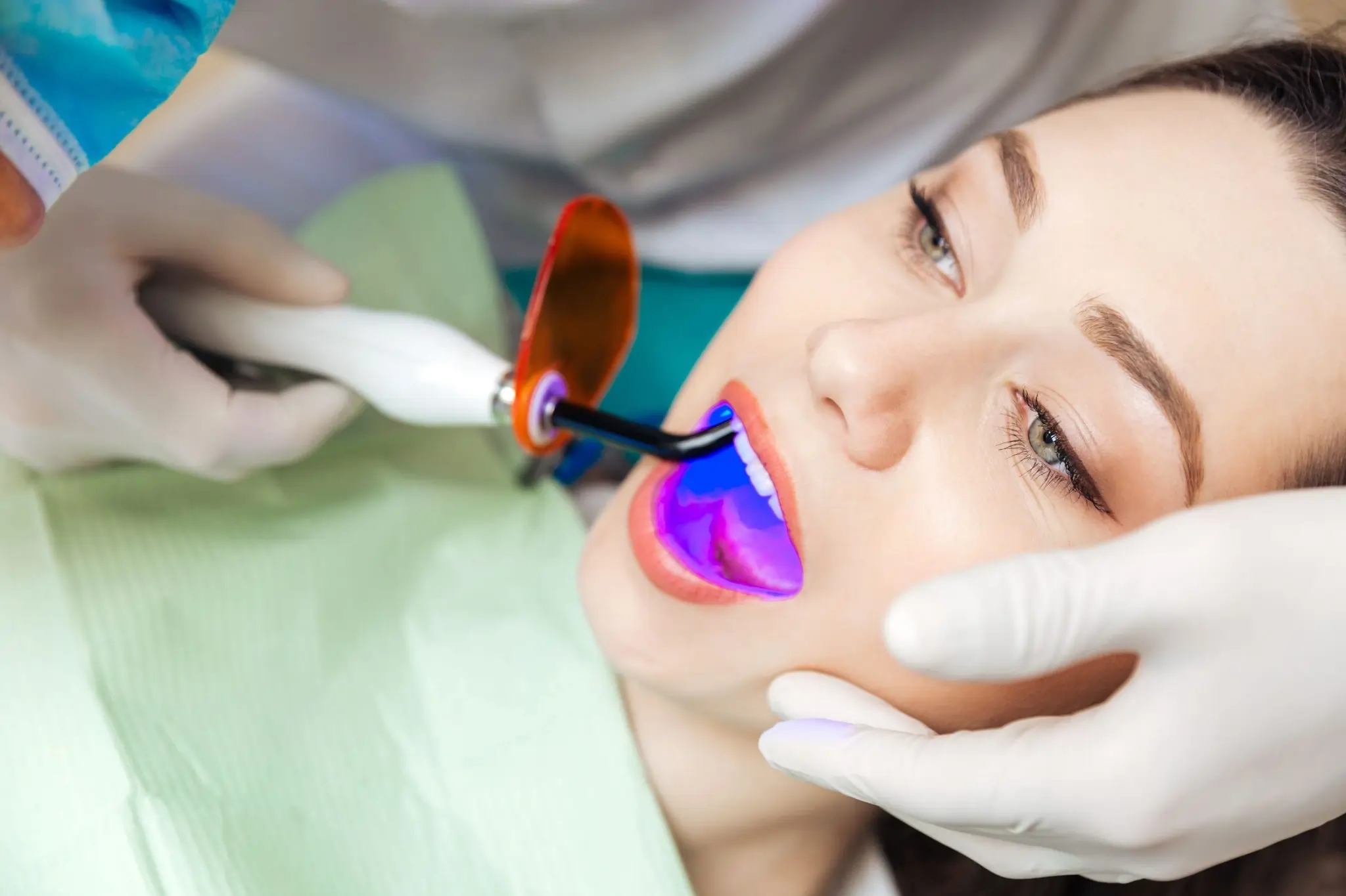 Common Risks of Whitening Without Expert Dental Guidance Salford