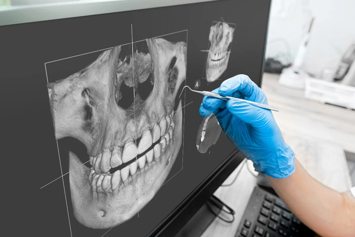 Key Benefits of 3D Printing for Patients and Dentists Salford