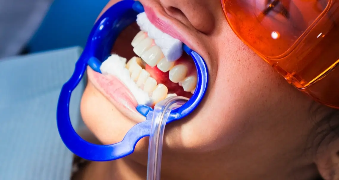 How Can Cosmetic Dentistry Boost Your Confidence Salford