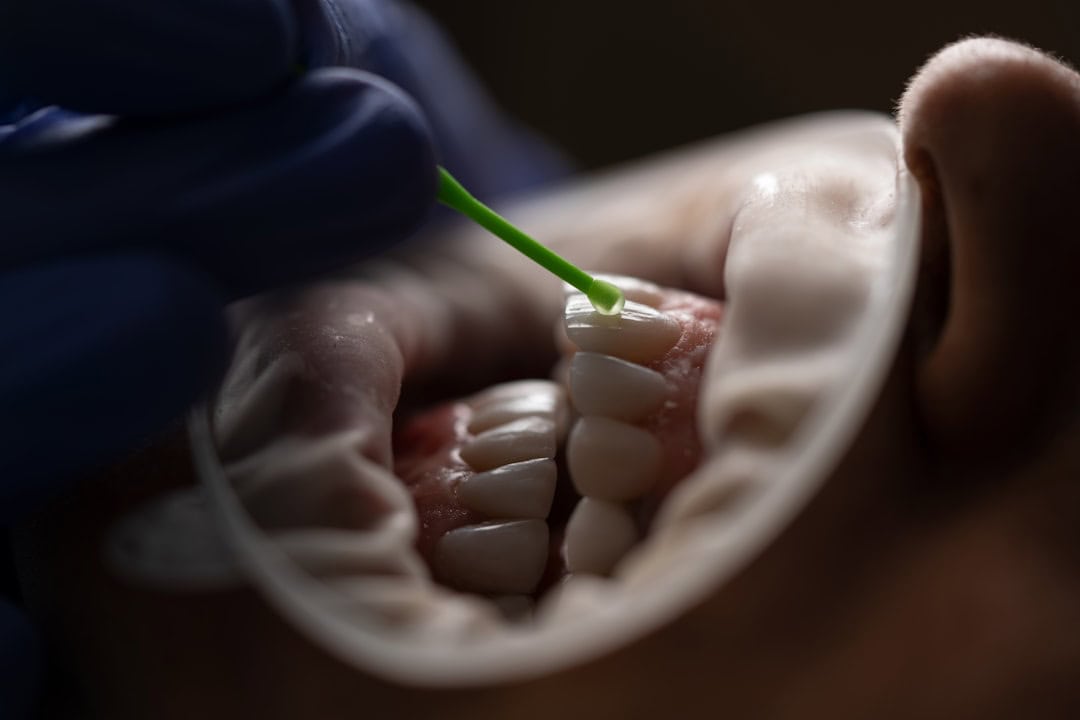 Common Causes of Persistent Dry Mouth Salford