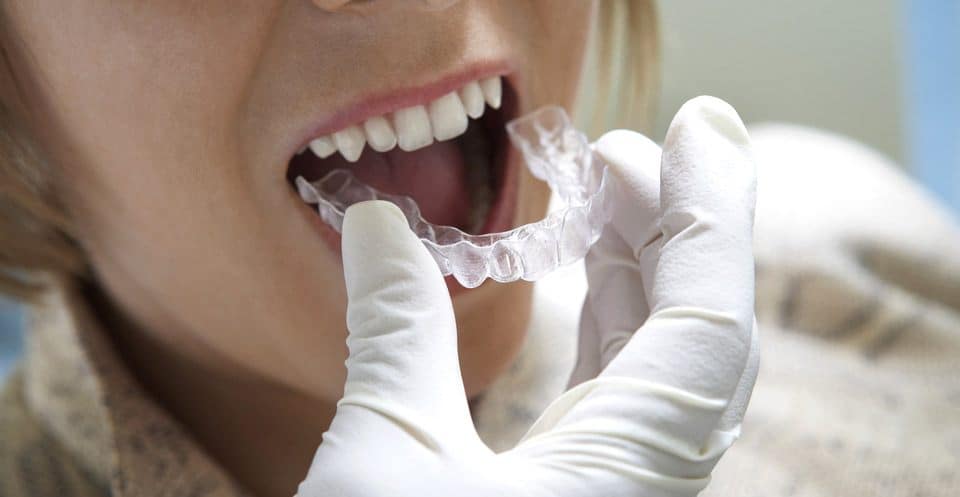 Can Bruxism Affect Your Sleep Quality Salford