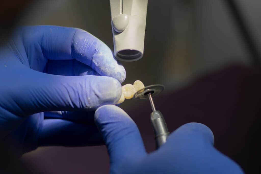 Customised Dental Solutions: Crowns, Aligners, and Implants Salford