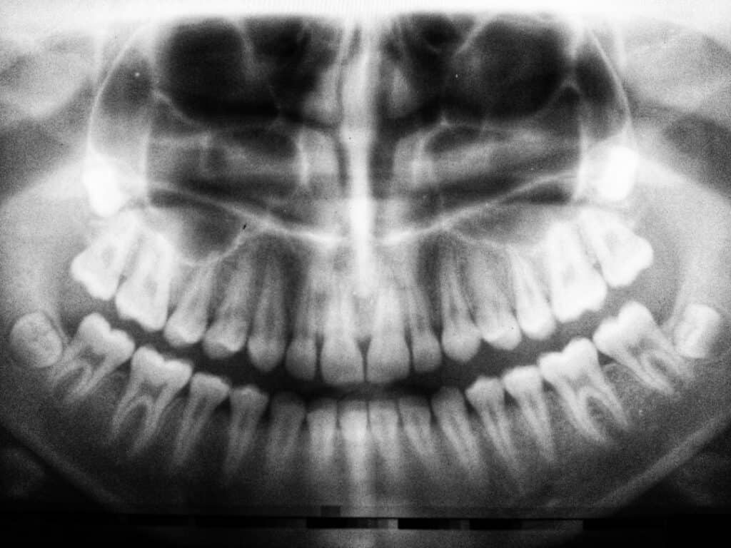 The Future of 3D Printing in Oral Healthcare Salford