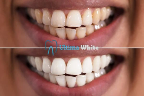 Long lasting results from Ultima White Salford